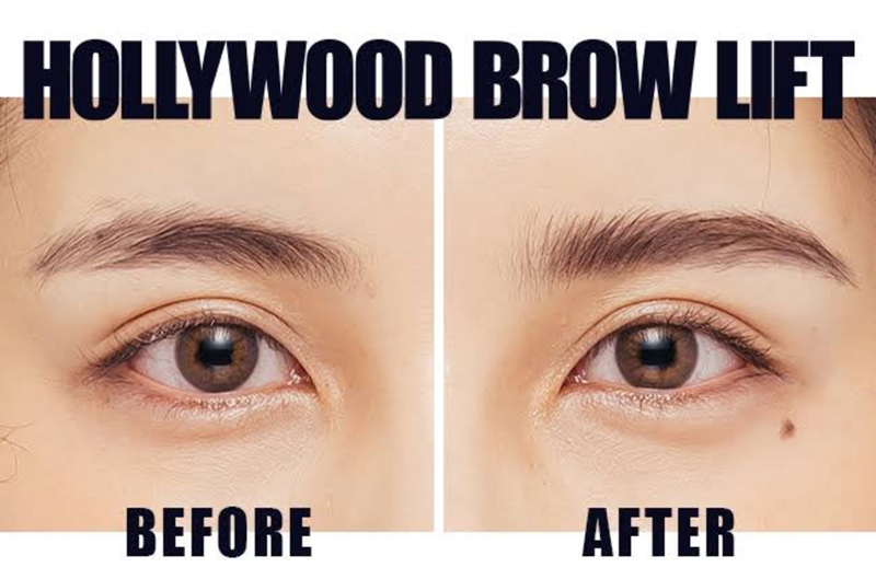 HOLLYWOOD BROWLIFT